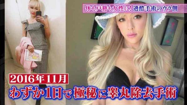 性転換手術して女になったGENKING、美人すぎるｗｗこれはかわいいｗｗ（画像）