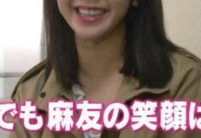 【衝撃画像】AKB48峯岸みなみ、誰だか判らないレベルにまで顔が変貌するｗｗｗｗｗｗｗｗｗｗ