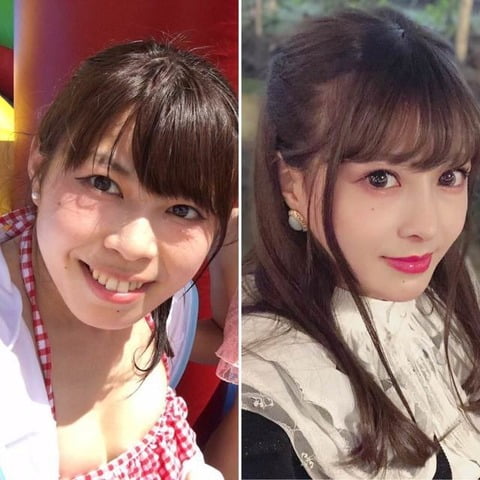 【画像】700万円もかけて整形した結果がこれｗｗｗｗｗｗｗ （※画像あり）