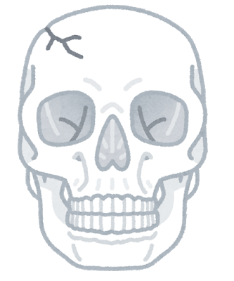 【画像】妹が工場で機械に巻き込まれた……【グロ注意】