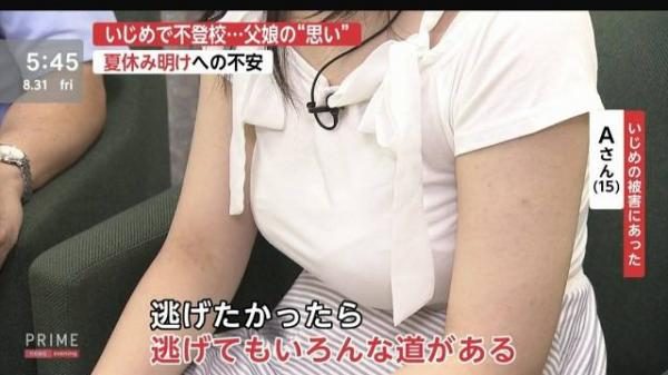 いじめを受けた女の子がテレビ出演した結果ｗｗｗ（gif動画）