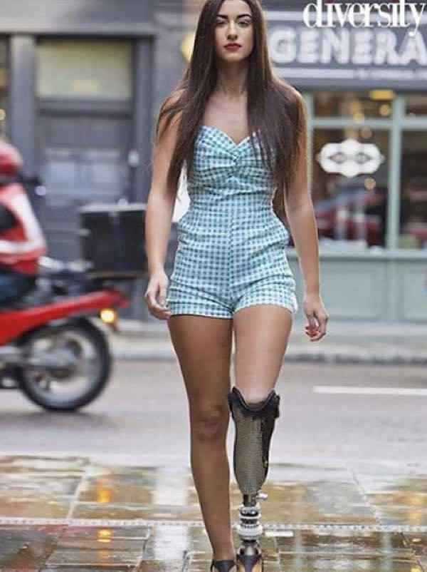 めっちゃかっこいい義足の美少女が発見されるｗｗｗただし炎上している模様ｗｗｗ（画像）